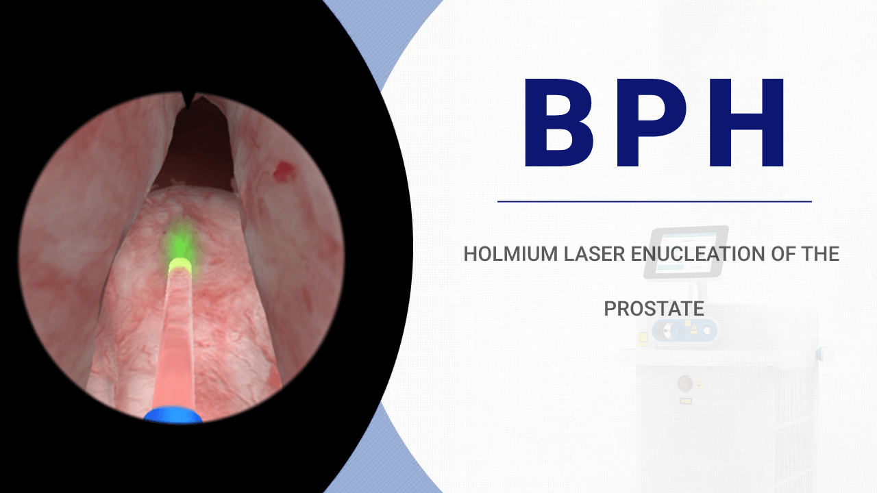 Holmium Laser Enucleation Of The Prostate 2